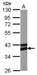Anti-Adiponectin Receptor 1 antibody [C2C3], C-term used in Western Blot (WB). GTX104770