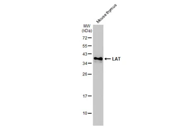 Anti-LAT antibody used in Western Blot (WB). GTX104771