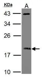 Anti-ARF3 antibody used in Western Blot (WB). GTX104782