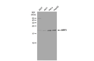 Anti-ARF5 antibody used in Western Blot (WB). GTX104783