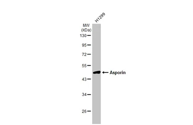 Anti-Asporin antibody [N3C1], Internal used in Western Blot (WB). GTX104790