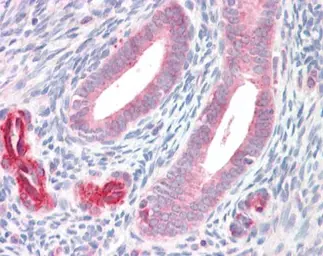 Anti-ADAM33 antibody [C2C3], C-term used in IHC (Paraffin sections) (IHC-P). GTX104804