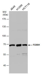 Anti-FOXN1 antibody [C3], C-term used in Western Blot (WB). GTX104849
