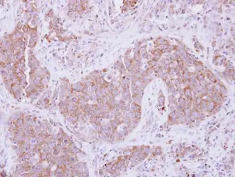 Anti-ADAM10 antibody [N2C1], Internal used in IHC (Paraffin sections) (IHC-P). GTX104940