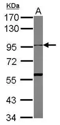Anti-ADAM10 antibody [N2C1], Internal used in Western Blot (WB). GTX104940