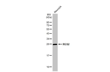 Anti-RGS2 antibody used in Western Blot (WB). GTX104944