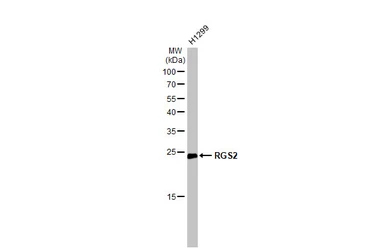 Anti-RGS2 antibody used in Western Blot (WB). GTX104944