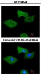 Anti-RGS2 antibody used in Immunocytochemistry/ Immunofluorescence (ICC/IF). GTX104944
