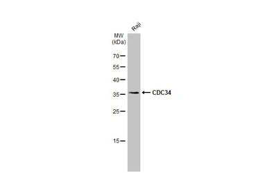 Anti-CDC34 antibody [N1C3] used in Western Blot (WB). GTX105013