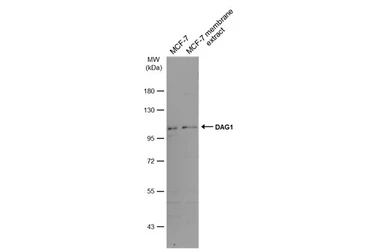 Anti-DAG1 antibody used in Western Blot (WB). GTX105038