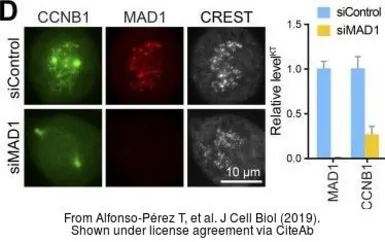 Anti-MAD1 antibody used in Immunocytochemistry/ Immunofluorescence (ICC/IF). GTX105079
