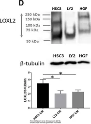 Anti-LOXL2 antibody used in Western Blot (WB). GTX105085
