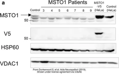 Anti-MSTO1 antibody [N1C1] used in Western Blot (WB). GTX105110