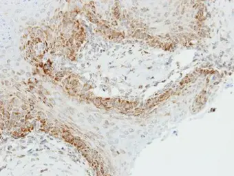 Anti-OGDH antibody [C2C3], C-term used in IHC (Paraffin sections) (IHC-P). GTX105124