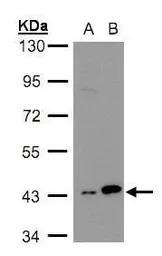 Anti-MAPKAP Kinase 3 antibody [N2C3] used in Western Blot (WB). GTX105147