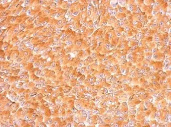 Anti-AIMP1 antibody used in IHC (Paraffin sections) (IHC-P). GTX105175