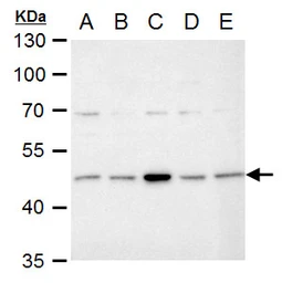 Anti-IDH1 antibody used in Western Blot (WB). GTX105179
