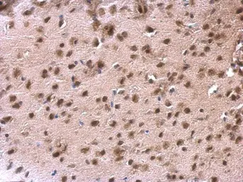 Anti-DDX1 antibody [N3C2], Internal used in IHC (Paraffin sections) (IHC-P). GTX105205