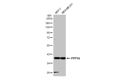 Anti-PPP1A antibody used in Western Blot (WB). GTX105255