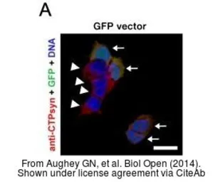Anti-CTP synthase antibody [N1C1] used in Immunocytochemistry/ Immunofluorescence (ICC/IF). GTX105265
