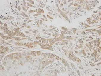 Anti-C1 inhibitor antibody [N1C3] used in IHC (Paraffin sections) (IHC-P). GTX105316
