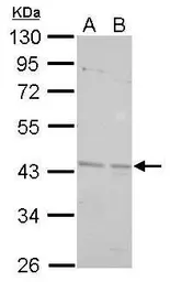 Anti-BRCC45 antibody used in Western Blot (WB). GTX105364