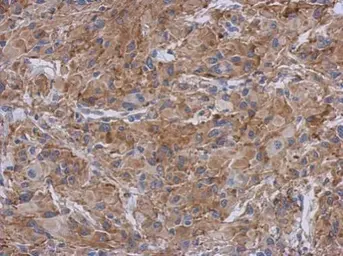 Anti-Radixin antibody used in IHC (Paraffin sections) (IHC-P). GTX105408