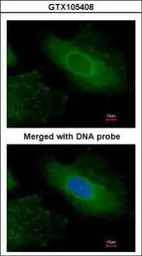 Anti-Radixin antibody used in Immunocytochemistry/ Immunofluorescence (ICC/IF). GTX105408