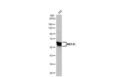 Anti-MEF2C antibody used in Western Blot (WB). GTX105433