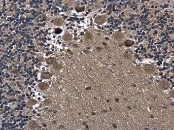 Anti-Axin 2 antibody [N2C2], Internal used in IHC (Paraffin sections) (IHC-P). GTX105442