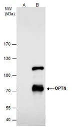 Anti-Optineurin antibody used in Immunoprecipitation (IP). GTX105447