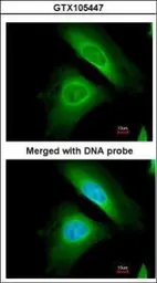 Anti-Optineurin antibody used in Immunocytochemistry/ Immunofluorescence (ICC/IF). GTX105447