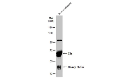 Anti-C1s antibody used in Western Blot (WB). GTX105464