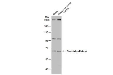 Anti-Steroid sulfatase antibody [N1C3] used in Western Blot (WB). GTX105498