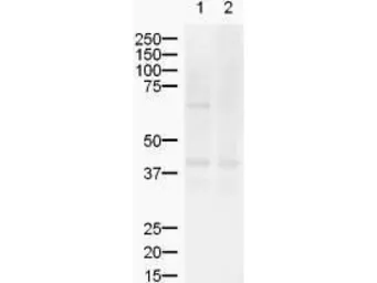 Anti-ZIC2 antibody used in Western Blot (WB). GTX10550