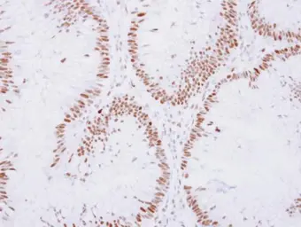 Anti-ZNF198 antibody used in IHC (Paraffin sections) (IHC-P). GTX105550