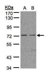 Anti-FLRT1 antibody [N1N3] used in Western Blot (WB). GTX105597