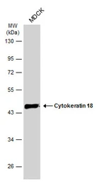 Anti-Cytokeratin 18 antibody [N2C2], Internal used in Western Blot (WB). GTX105624