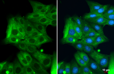 Anti-Cytokeratin 18 antibody [N2C2], Internal used in Immunocytochemistry/ Immunofluorescence (ICC/IF). GTX105624