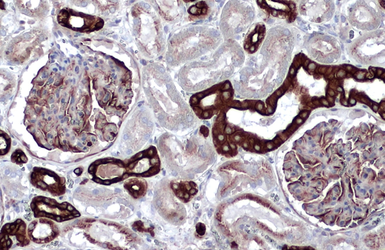 Anti-Cytokeratin 18 antibody [N2C2], Internal used in IHC (Paraffin sections) (IHC-P). GTX105624