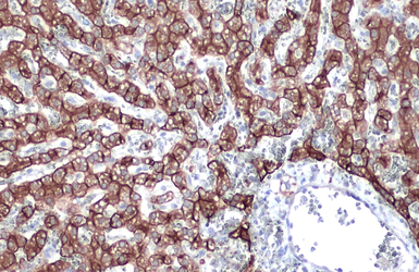 Anti-Cytokeratin 18 antibody [N2C2], Internal used in IHC (Paraffin sections) (IHC-P). GTX105624