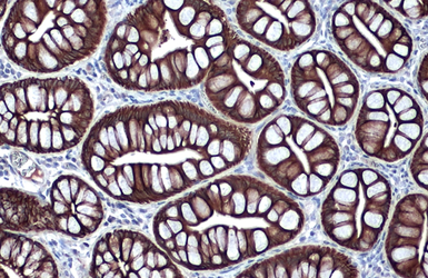Anti-Cytokeratin 18 antibody [N2C2], Internal used in IHC (Paraffin sections) (IHC-P). GTX105624