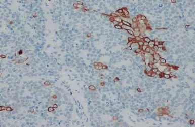 Anti-Cytokeratin 18 antibody [N2C2], Internal used in IHC (Paraffin sections) (IHC-P). GTX105624
