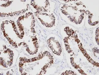 Anti-Cytokeratin 18 antibody [N2C2], Internal used in IHC (Paraffin sections) (IHC-P). GTX105624