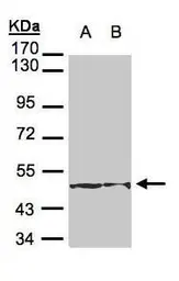 Anti-Cytokeratin 18 antibody [N2C2], Internal used in Western Blot (WB). GTX105624