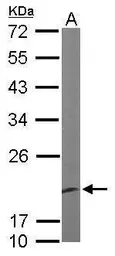 Anti-EEF1E1 antibody [N1C3] used in Western Blot (WB). GTX105658