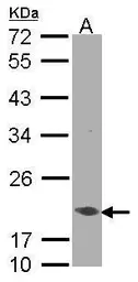 Anti-EEF1E1 antibody [N1C3] used in Western Blot (WB). GTX105658