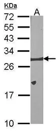Anti-Bcl-X antibody used in Western Blot (WB). GTX105661