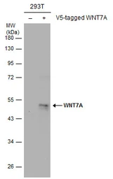 Anti-Wnt7a antibody used in Western Blot (WB). GTX105680