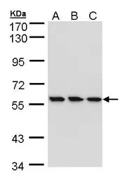 Anti-HCE antibody [N1N3] used in Western Blot (WB). GTX105694